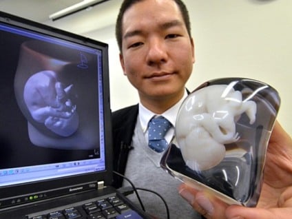 Fasotec cria moldes de fetos em 3D para pais ansiosos
