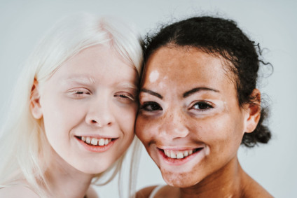 Group of multiethnic women with different kind of skin posing together in studio. Concept about body positivity and self acceptance; Shutterstock ID 1922089577; purchase_order: -; job: -; client: -; other: –
